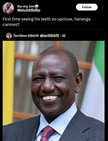 Kamy son muchiilike follow first time seeing his teeth so upclose, hananga canin