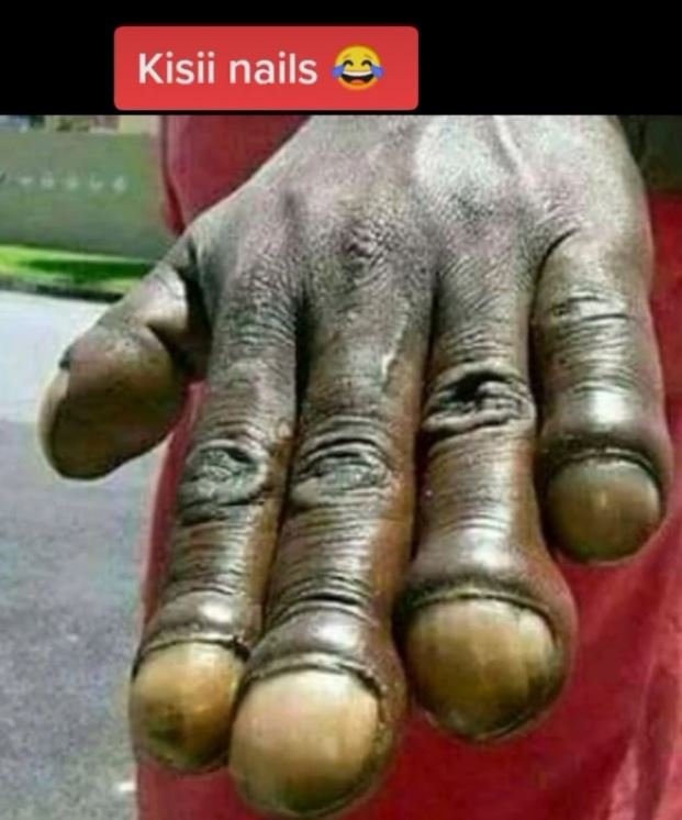 Kisii nails