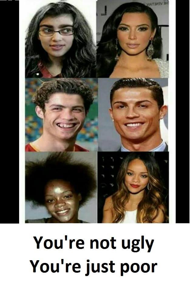 You're not ugly you're just poor