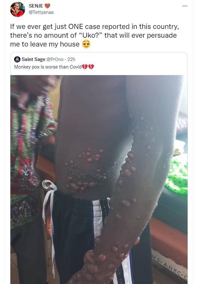 Senje tettyanaa if we ever get just one case reported in this country there's no