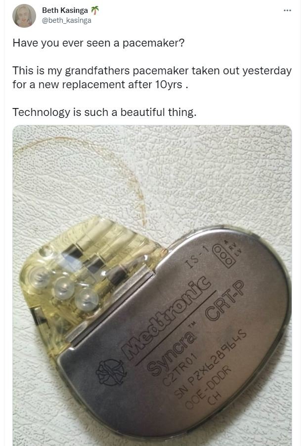 Beth kasinga beth_kasinga have you ever seen a pacemaker? this is my grandfather