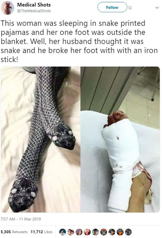 Medical shots themedicalshots follow this woman was sleeping in snake printed pa