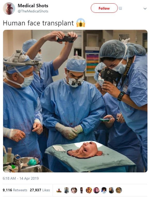 Medical shots themedicalshots follow human face transplant 6,18 am 14 apr 9,116