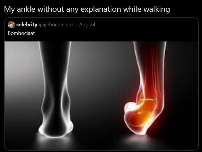 My ankle without any explanation while walking celebrity ijebuconcept_ aug 24 bo