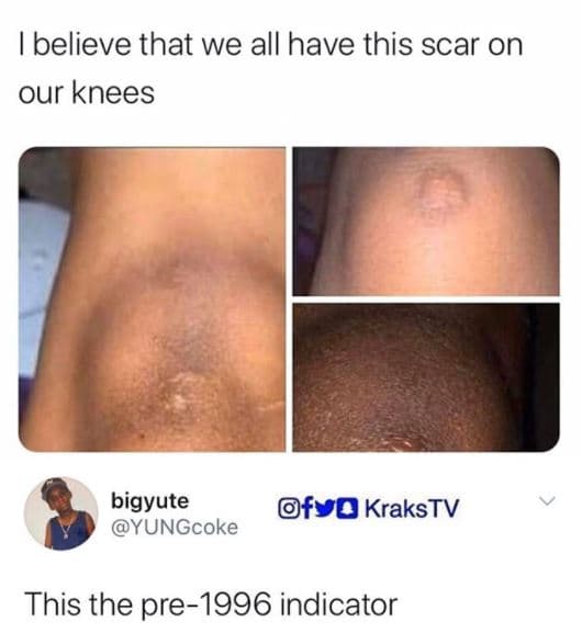 Ibelieve that we all have this scar on our knees bigyute yungcoke fyo krakstv th