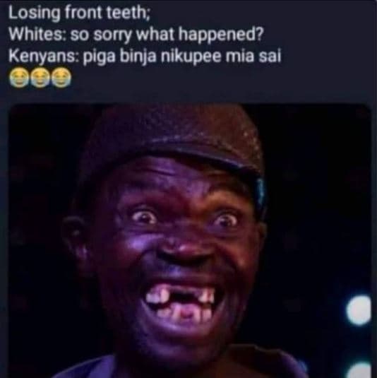 Losing front teeth whites so sorry what happened? kenyans piga binja nikupee mia