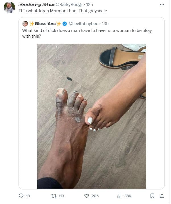 Sackars sina barkyboogz 12h this what jorah mormont had. that greyscale glossian