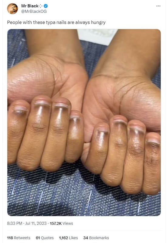 Mr black mrblackog people with these typa nails are always hungry 8.33 pm . jul