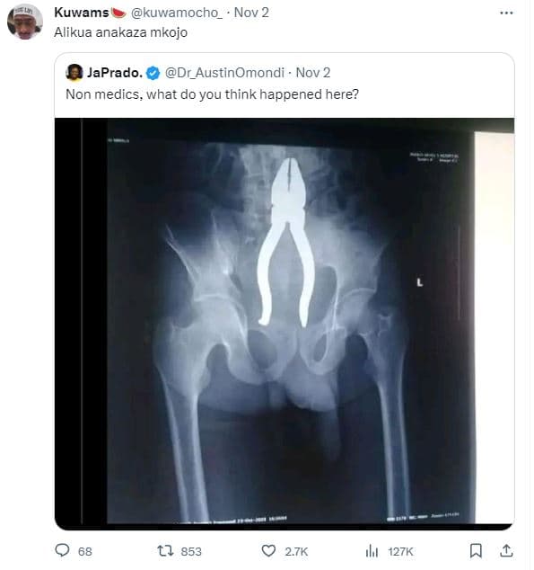 Kuwams kuwamocho_ nov 2 alikua anakaza mkojo japrado dr_austinomondi nov 2 non m