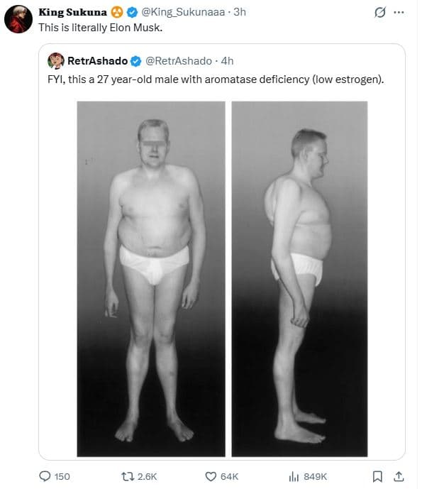 King sukuna king_sukunaaa 3h this is literally elon musk. retrashado retrashado