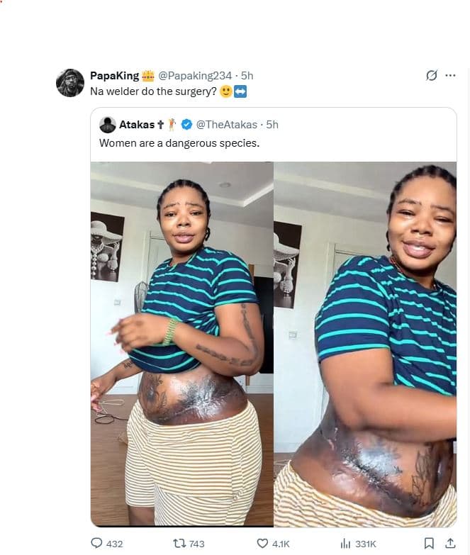 Papaking papaking234 5h na welder do the surgery? atakas t theatakas . 5h women